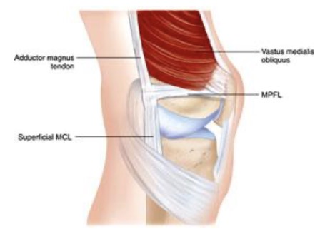 Medial Patellofemoral Ligament Mpfl Gorav Datta