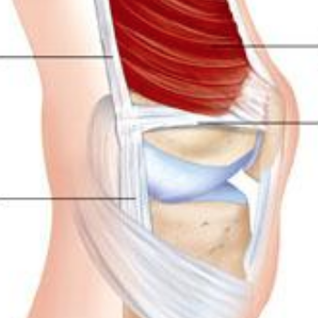 Medial Patellofemoral Ligament (MPFL)