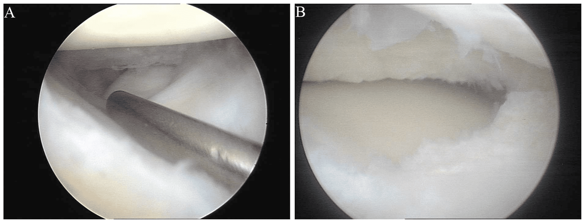 Knee Arthroscopy Gorav Datta