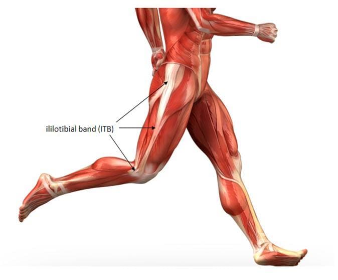 What is iliotibial band friction syndrome and what are its causes?